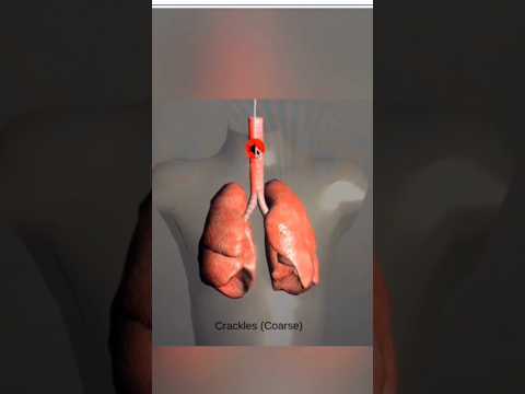 Abnormal Lung Sounds!!