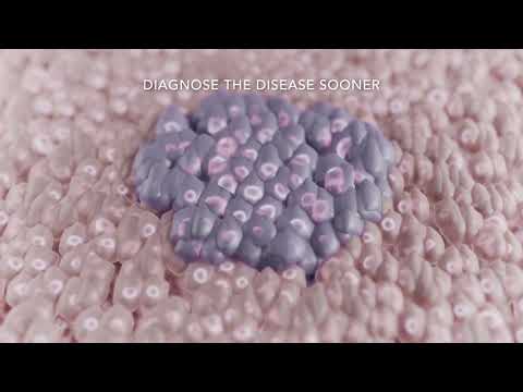 PanCanRisk - Personalized bioinformatics for cancer identification and clinical management