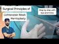 Inguinal Hernia Surgical Principles Of Lichtenstein Repair Dr Tayyab Riaz Ch
