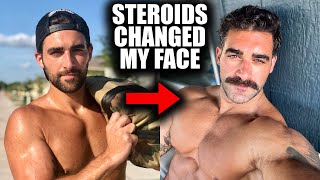 How PEDs Changed My Face And Body | Unexpected Changes From Steroids