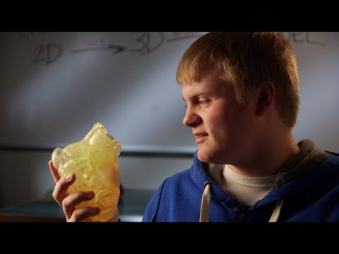 3D Printed HeartPrint® Model Helps 16 Year Old Heart Tumor Patient