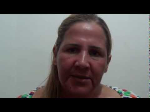 1°Horas da 2° sessão do laser Co2-vd7