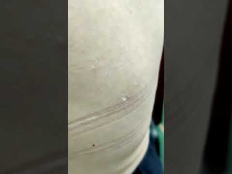 Дерматовенерология