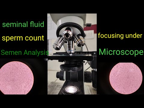 semen analysis#sperm count#seminal fluid#semen analysis#medico lover#semen under microscope#medico#