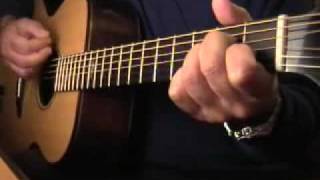 Mannaggia alla musica