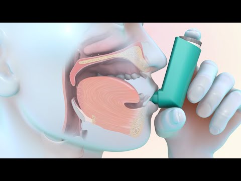 Como usar un inhalador de dosis medidas
