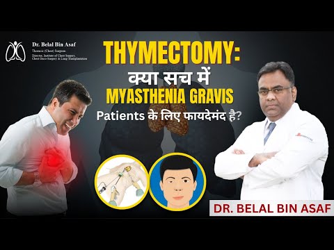 Thymectomy: क्या Myasthenia Gravis के मरीजों के लिए है फायदेमंद? जानें सच्चाई - Dr Belal Bin Asaf