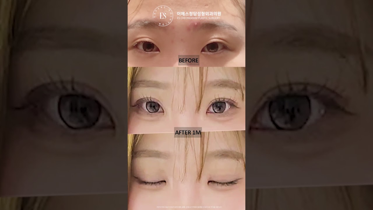 이에스 유튜브