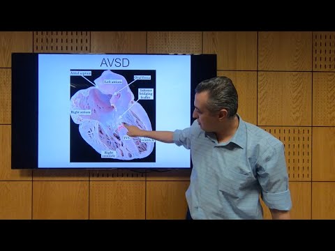 AVSD (AV Canal) - Hatem Hosny