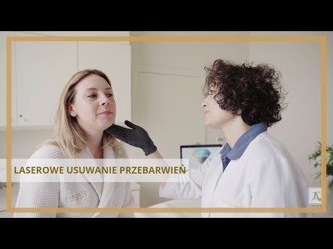 Laserowe usuwanie przebarwień | Ambasada Urody w Warszawie