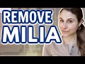 TOP 5 products for MILIA REMOVAL| Dr Dray