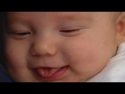 Making C-Sections easier