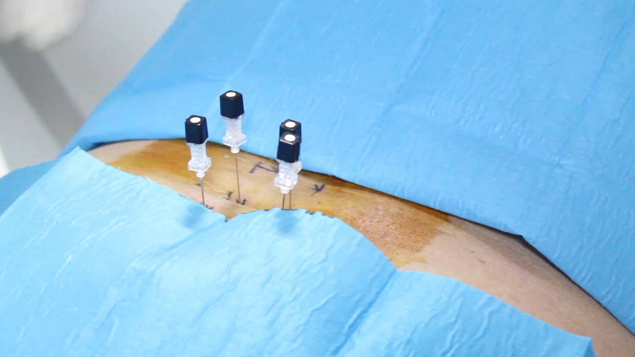 Francesco Colucci-18