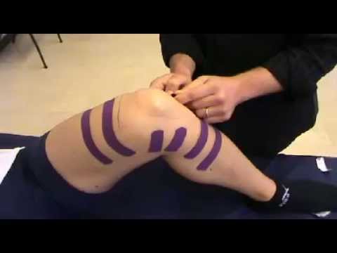 Osteocondrosi delle articolazioni cervicali Come ripristinare larticolazione dellanca senza chirurgia