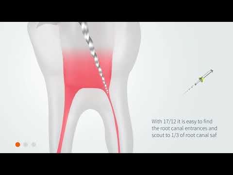 Bondent UDG CC Premium V.EU (Version Europe) Dental Rotary Files