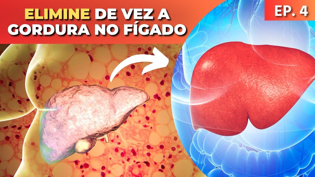 GORDURA NO FÍGADO: O QUE É, SINTOMAS E COMO ELIMINAR DE VEZ | Dr Dayan Siebra