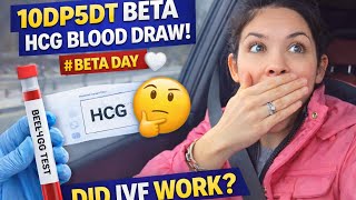 10DP5DT Beta HCG Results 🤍 Did Our Euploid Embryo Implant! | IVF Blood Draw Day
