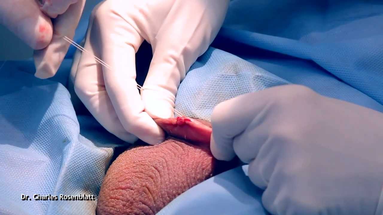 Charles Rosenblatt-23