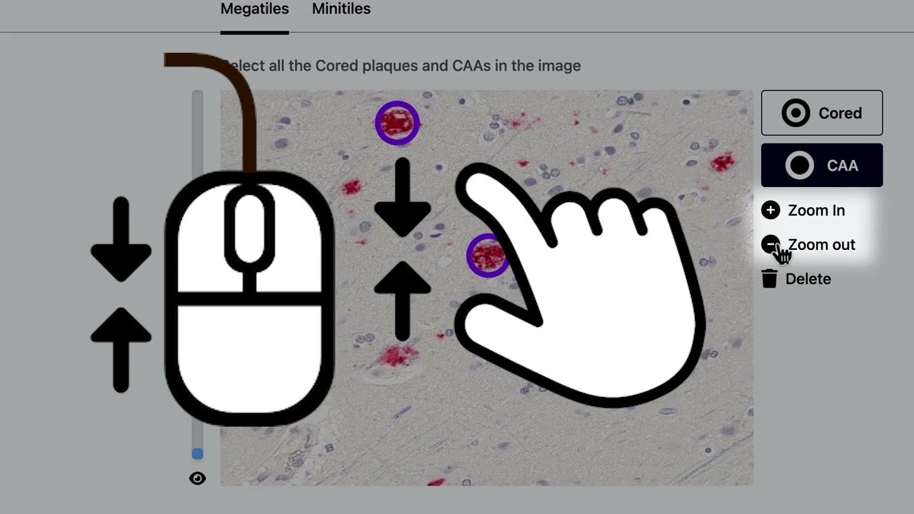 Thumbnail preview of Beta Catchers tutorial v1.0