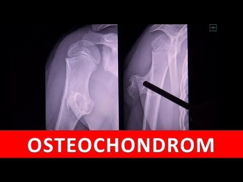 Aufgrund dessen, was kann schwer verletzt Lende Terpentin für den gemeinsamen Einkauf