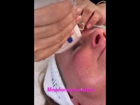MesoBoost – video