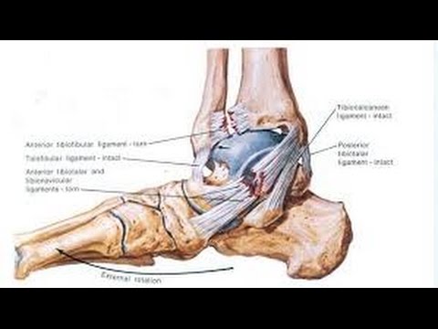 Carica alla spalla periartrite articolazione Qual è losteomielite articolazione della spalla
