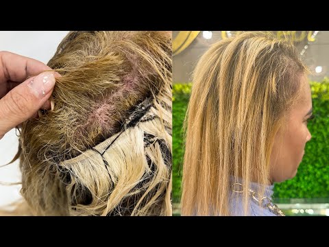 TRANSFORMAÇÃO - De dor e desespero a um novo visual cheio de autoestima!