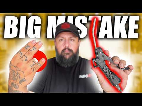 How I Lost My Finger (Full Story)