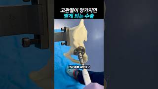 고관절 수술