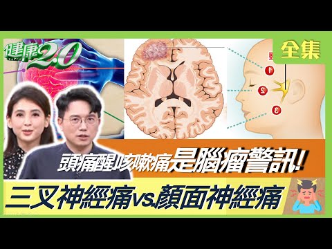 咳嗽 頭痛