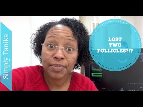 IVF Stims Day 7. Where Did My Follicles Go? Video