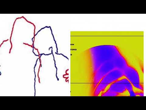 Losing Focus vs. Next To Me (Mashup) Marc Benjamin x Marcus Santoro x David Pietras vs Otto Knows