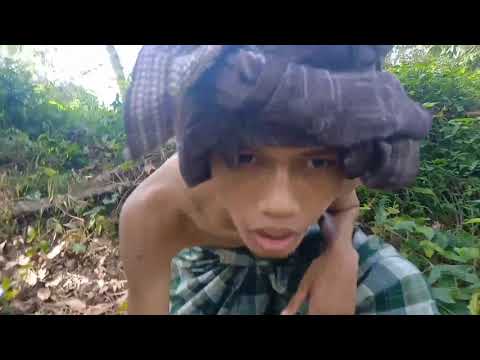 Tabrak lari patah tulang pasang...?