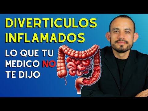 📛 DIVERTICULITIS Symptoms, Diagnosis and Treatment 2024