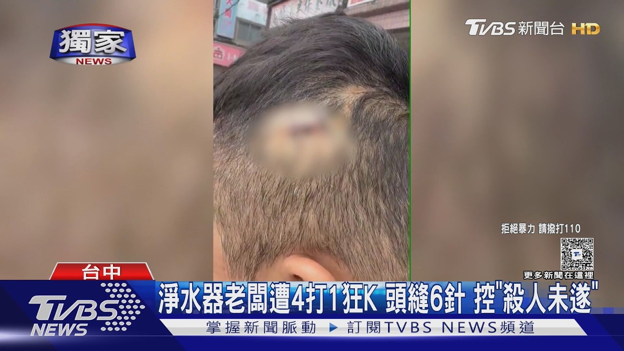 影音／獨／拒同桌飲酒遭暴打！男頭縫6針怒控：根本是殺人未遂