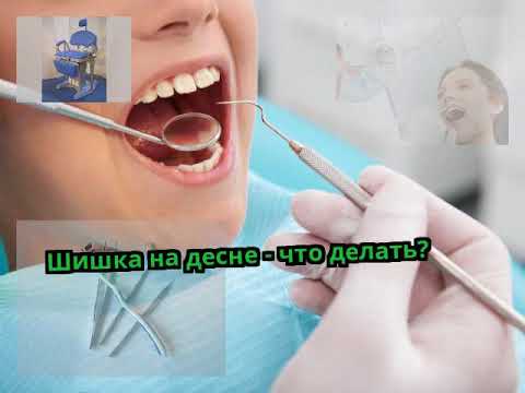 Шейный остеохондроз по немецки Боли в спине частые мочеиспускания задержка