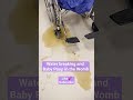 Water Breaking And Baby Poop In The Womb Shorts