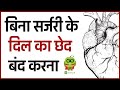 बिना सर्जरी के दिल का छेद बंद करना Hole In Hea