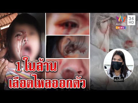 ฟีฟายแอดวาด