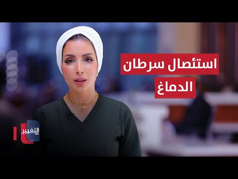 شاهد بالفيديو.. من داخل غرفة العمليات.. استئصال لسرطان الدماغ والمريضة مستيقظة | عوافي
