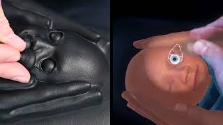 Eyesi Indirect Ophthalmoscope ROP Simulator (Eyesi Indirect ROP)