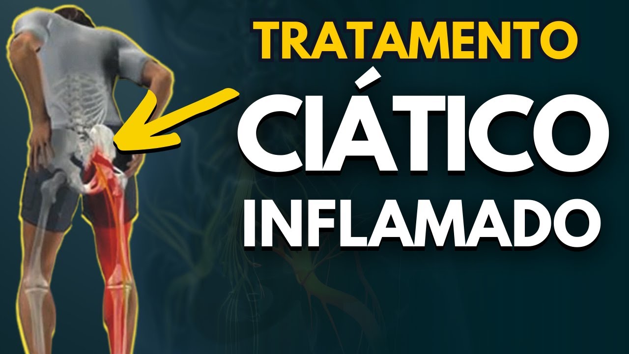 HOW TO TREAT INFLAMED SCIATIC? Pain relief exercises