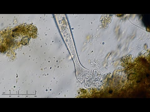 Lacrymaria feeding - 3 scenes
