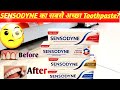 Sensodyne Toothpaste | Sensodyne | Sensodyne Toothpaste Ke Fayde | Best Sensodyne Toothpaste