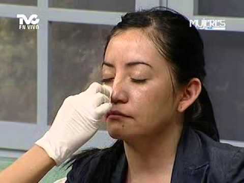 Candeggiare una faccia da pigmentary nota la crema Sciocchezze per eliminazione di posti di pigmentary
