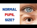Are your pupils normal size?