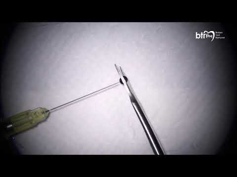 Broken Tool Remover BTR Pen Preparation