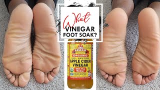 Does It work? Apple Cider Vinegar Foot Soak. A Natural Cure For Dry Feet