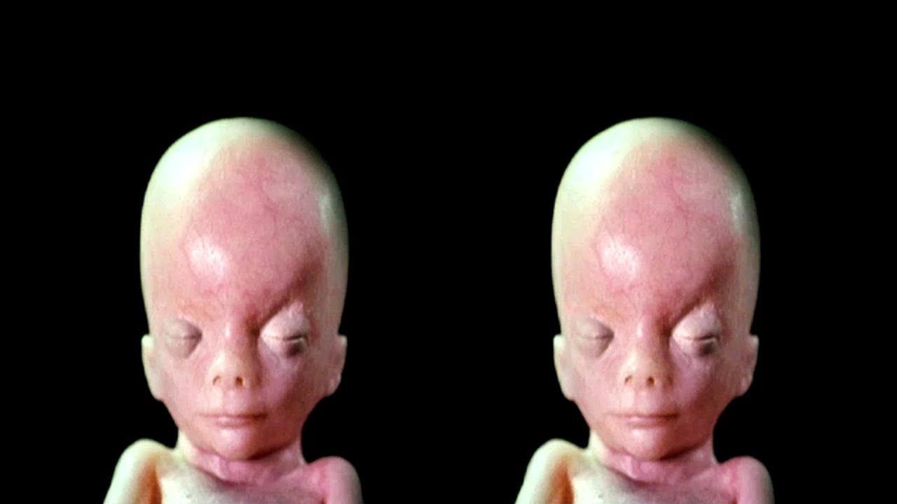 In the Womb: Identical Twins
