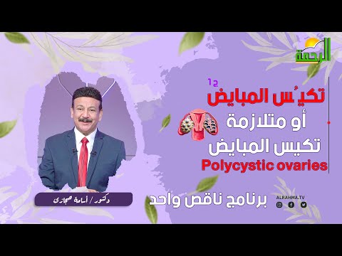 تكيُس المبيايض ج 1 ناقص واحد للدكتور أسامة حجازى